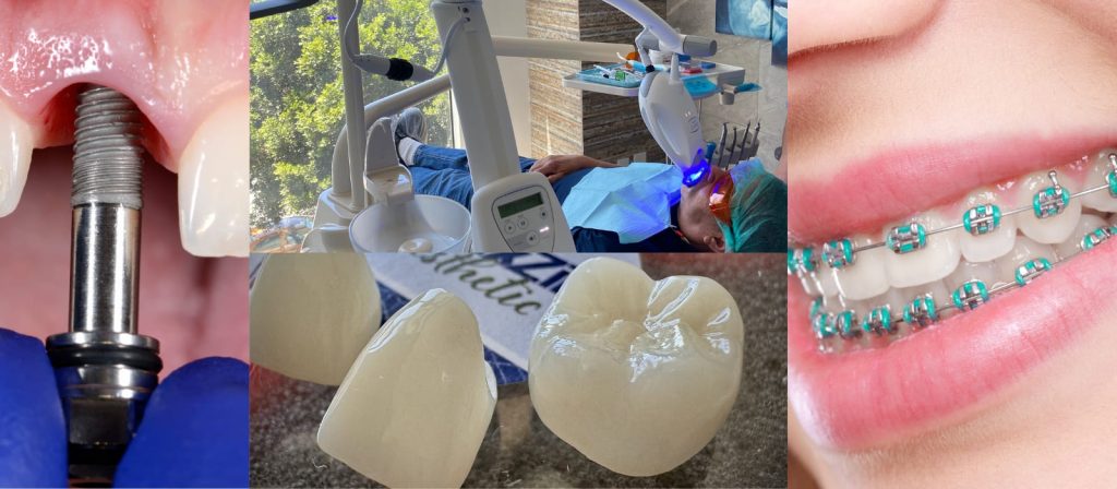 Comprehensive range of dental treatments offered at Beauty Smile Dental Studio in Tijuana, catering to dental tourism patients.